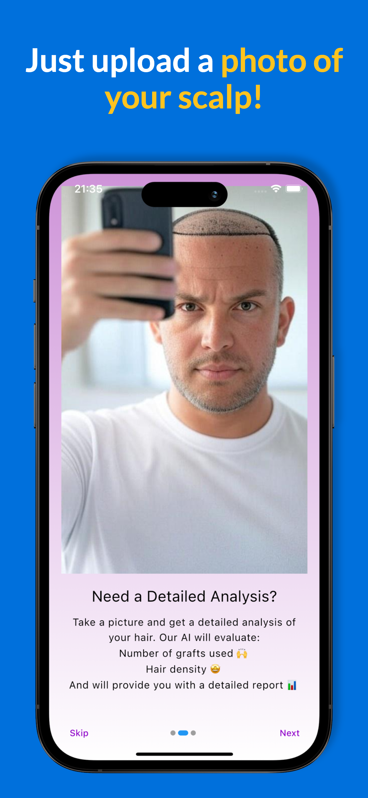 Screenshot of AI evaluation results on hair transplant