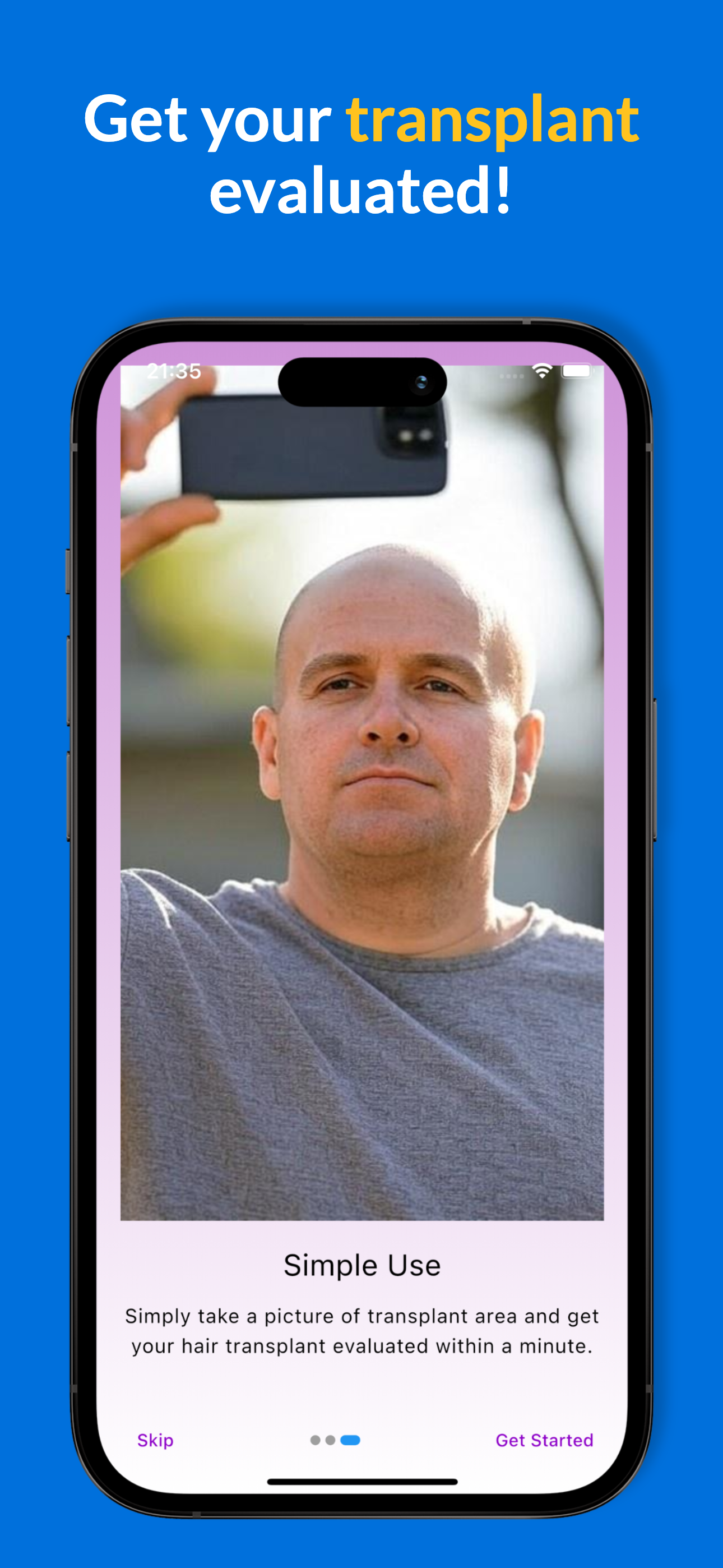 Healing progress screen after hair transplant