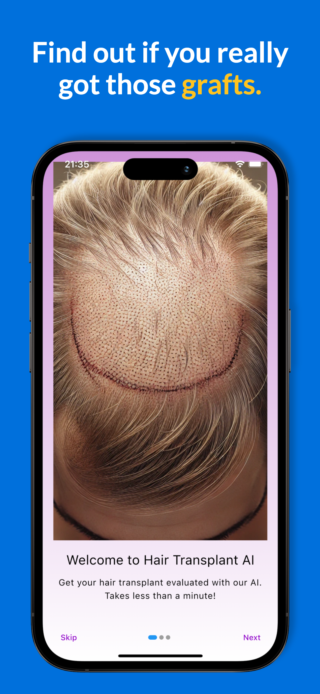 User photo upload interface in app