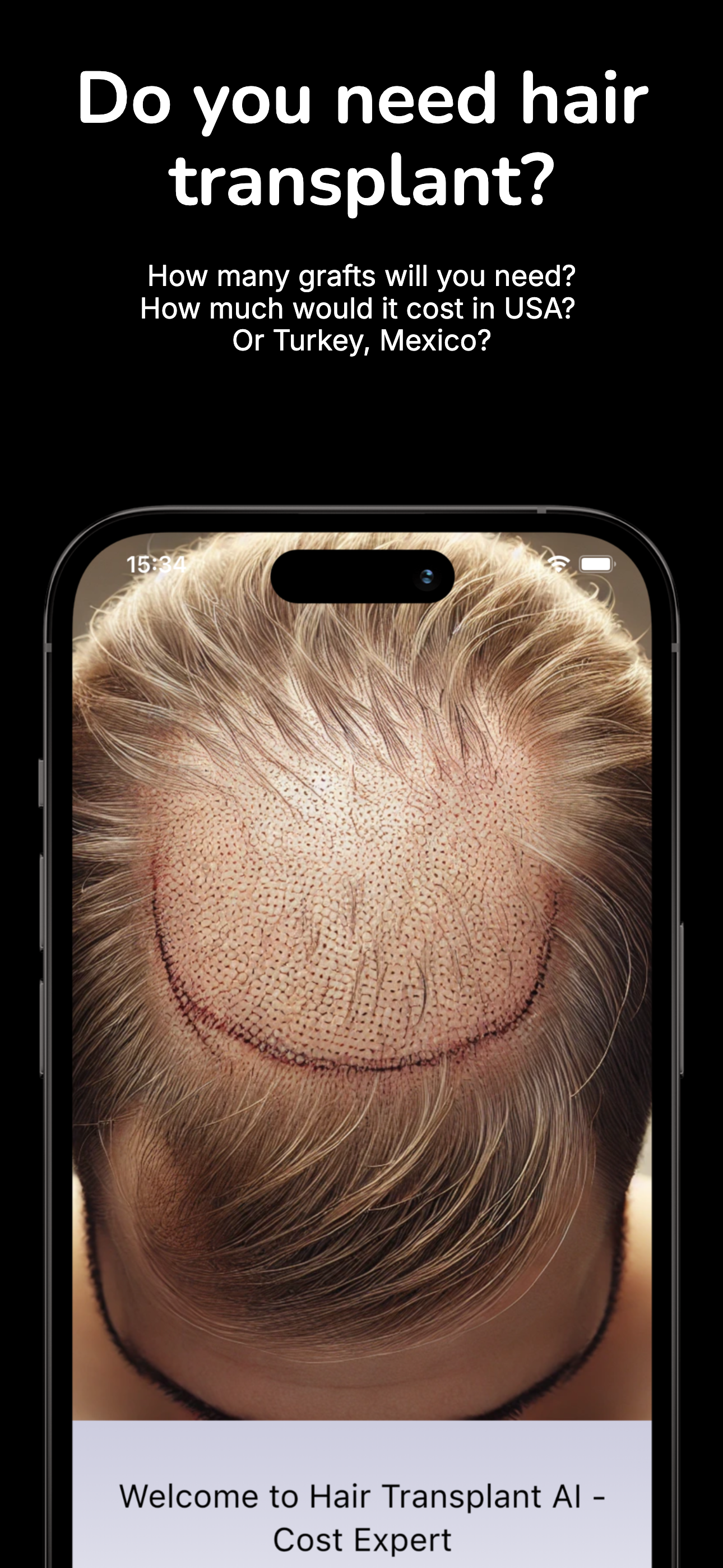 AI estimating hair transplant cost - screenshot 1