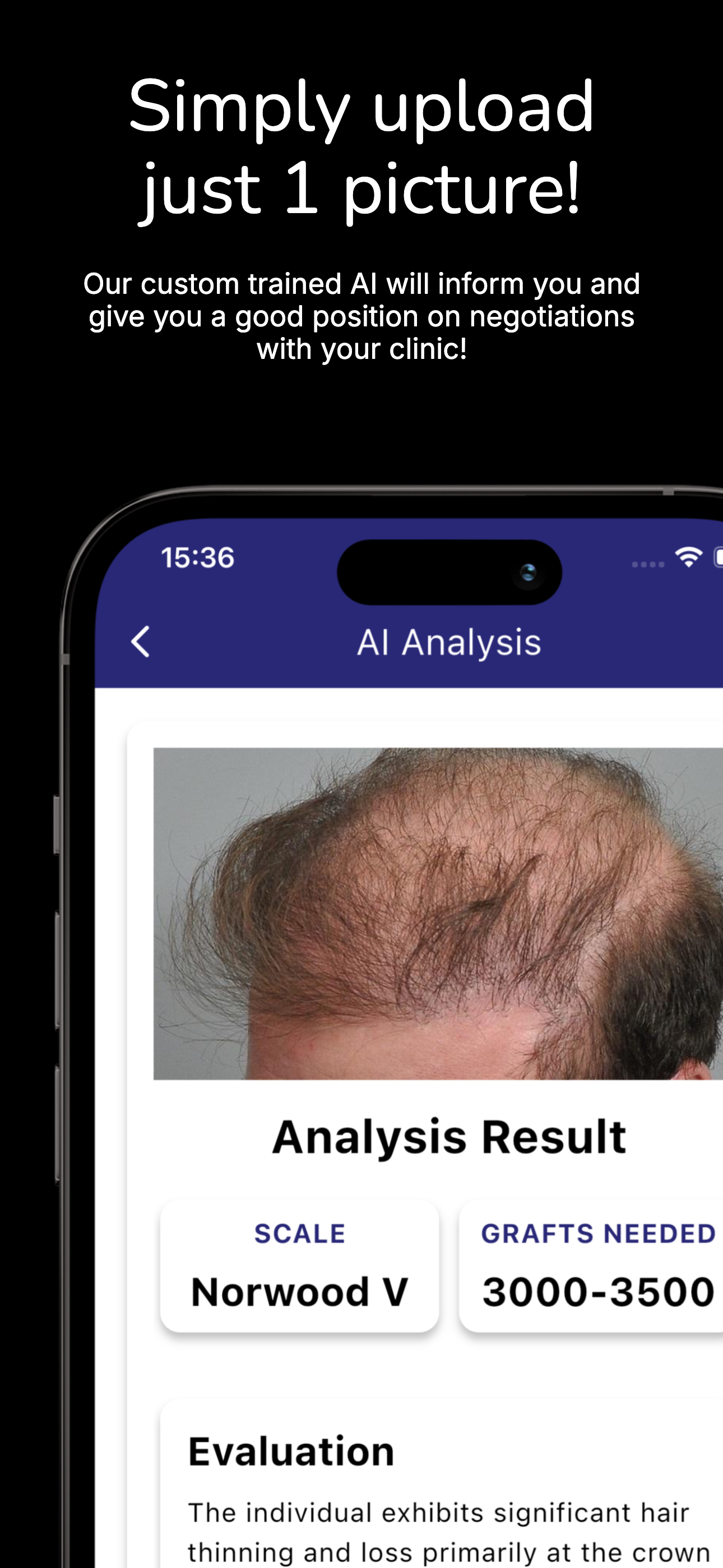 Hair loss level selection - screenshot 3
